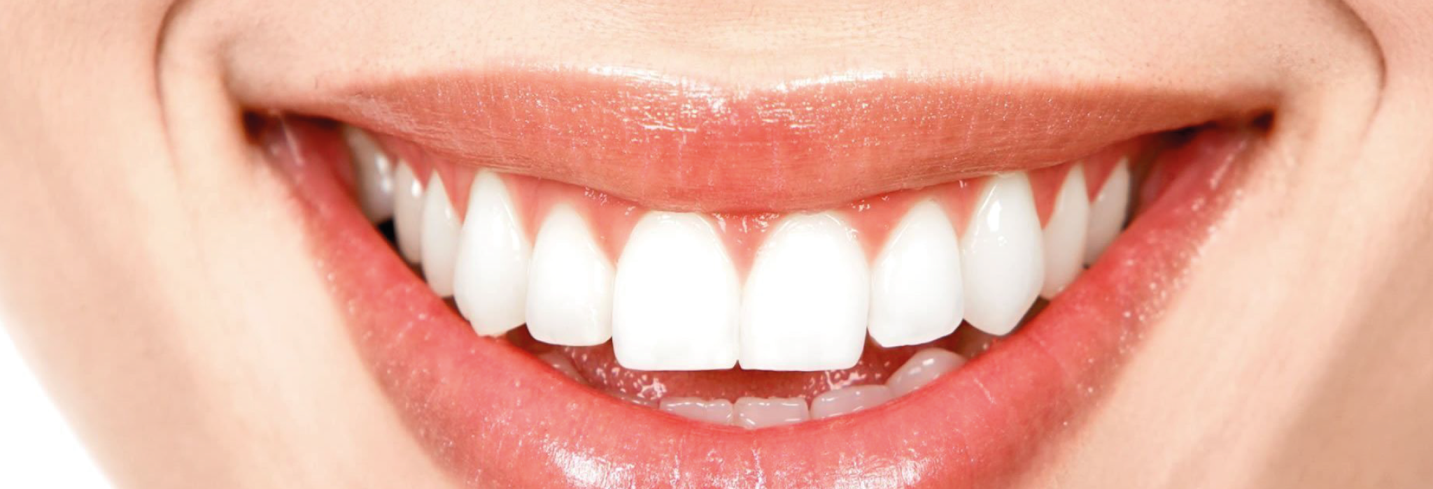Implantes-dentales-3
