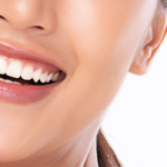 Implantes-dentales-4